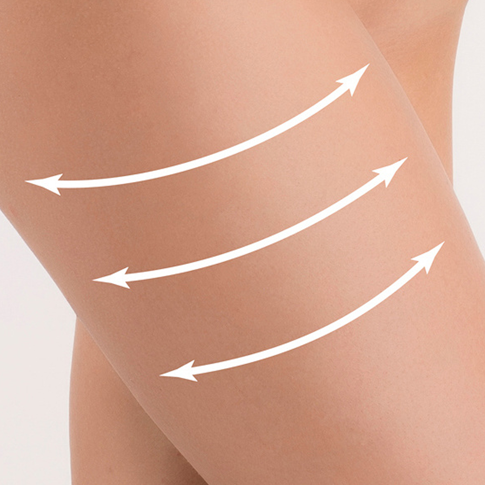 Crema Forte Corpo Cellulite & Smagliature